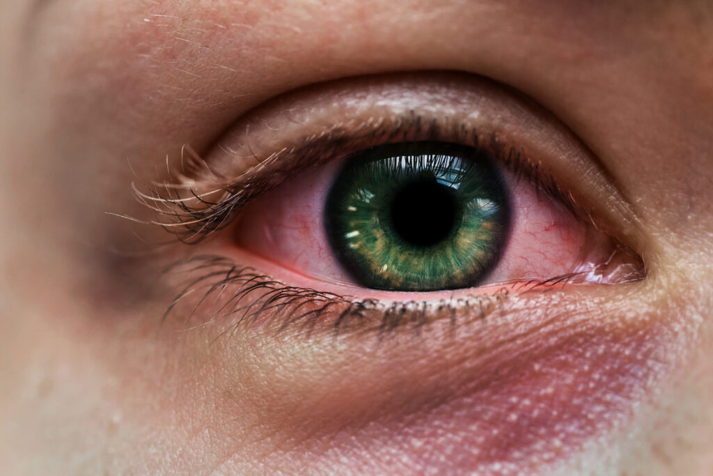 Top 10 Early Warning Signs of Eye Diseases You Should Never Ignore