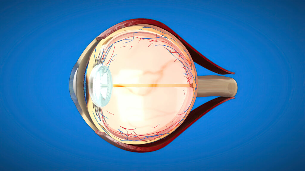Eye Check-Up Before Diabetes, BP or Thyroid Surgery: Why Retina Screening Matters